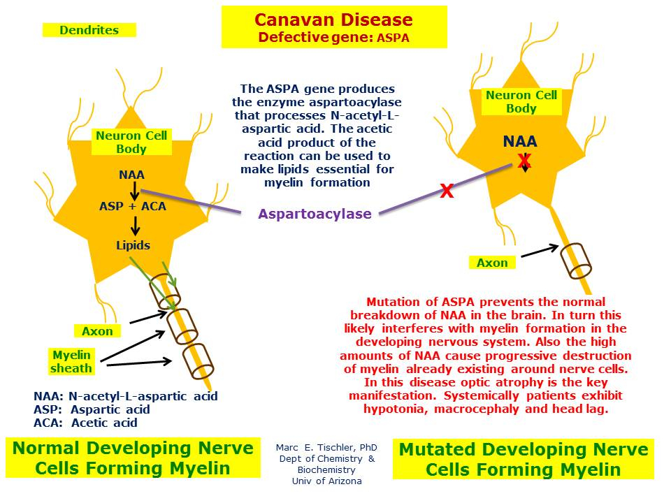 Canavan Disease Hereditary Ocular Diseases