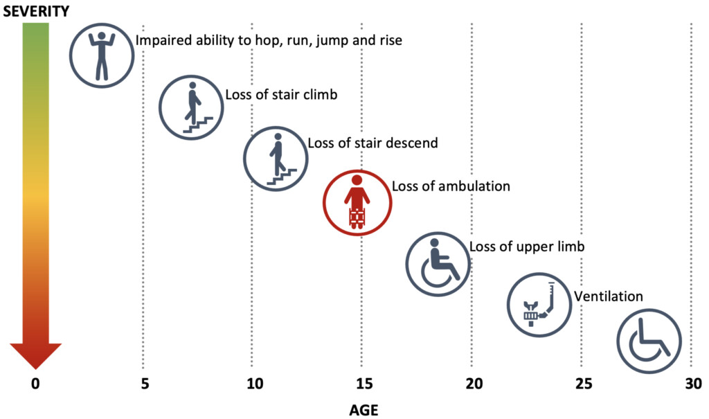 Duchenne Muscular Dystrophy Overview Capricor Therapeutics Inc CAPR 