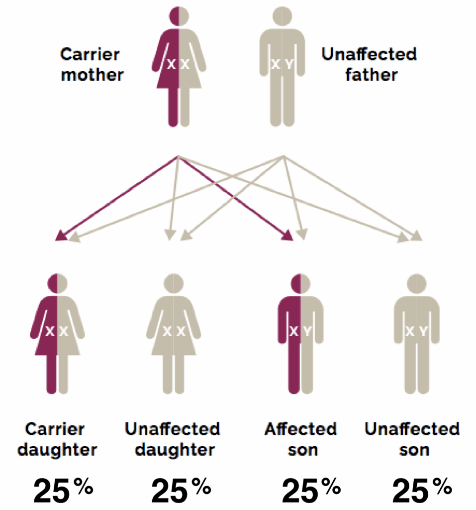 Duchenne Muscular Dystrophy Pedigree Chart