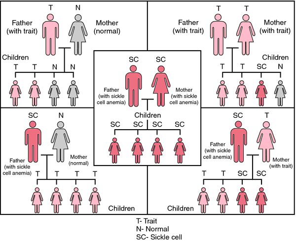 Genetic Cause Sickle Cell Anemia