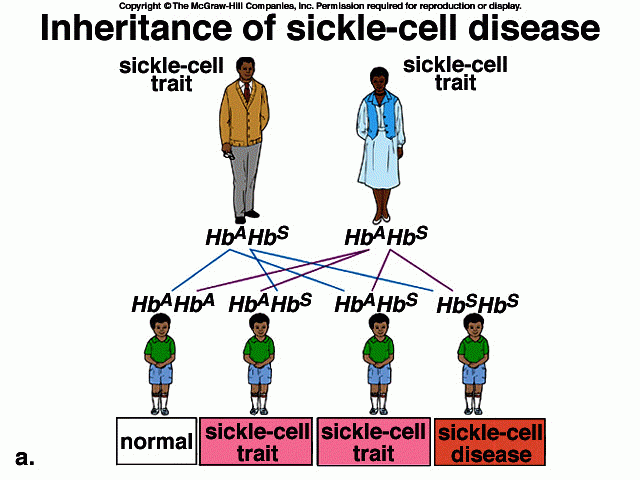 Health Living With Sickle Cell Anemia Genesis International