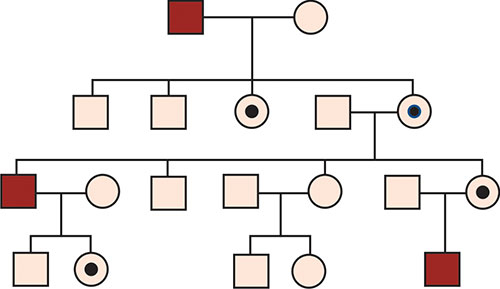 Klinefelter Syndrome Pedigree