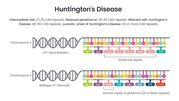 Premium Vector Huntington 39 s Disease Htt Repeat Allele Vector 