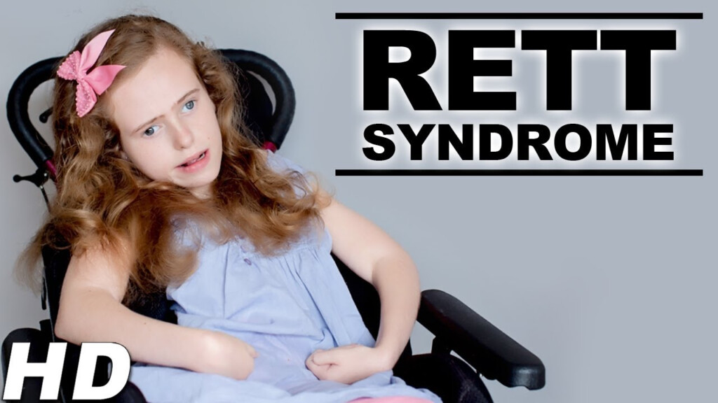 Rett Syndrome Life Expectancy Chart