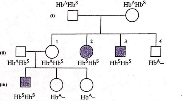 Sickle Cell Anaemia Pedigree Chart