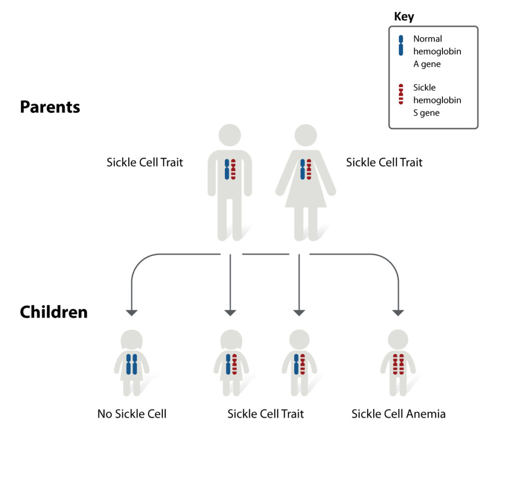Sickle Cell Anemia Chart