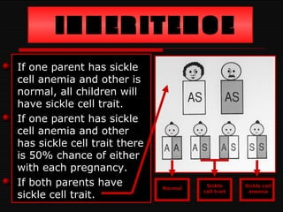 Sickle Cell Anemia PPT Free Download